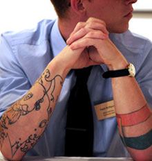 Tattoo Removal